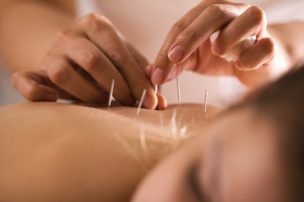 From Stress to Rest: Why Lawrence Residents Choose Acupuncture for Sleep & Energy