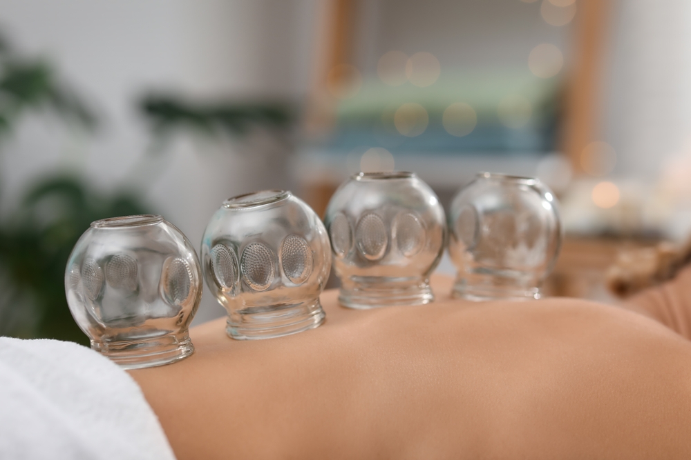 Cupping Therapy Benefits for Muscle Tension and Pain Relief